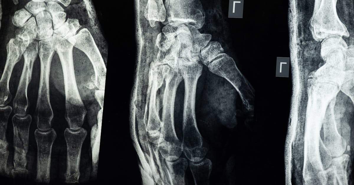 Zdravé kosti: tipy pro pevné kosti a zdravý životní styl