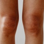 Zdravé klouby: tipy pro pohyblivost, prevenci bolesti a lepší každodenní život